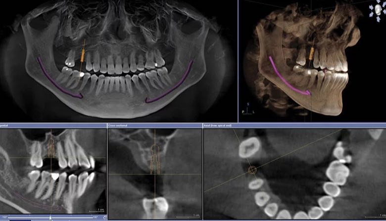 image cone beam